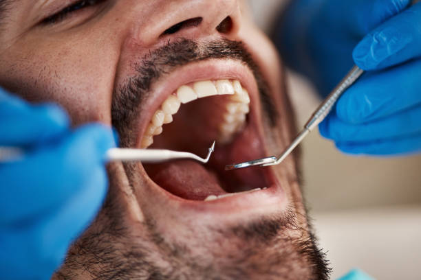 Best Emergency Dental Care for Sports Injuries in Lancaster, KY